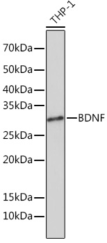 Confocal imaging of paraffin-embedded Rat brain  using BDNF Rabbit mAb (TA425874,dilution 1:200)  followed by a further incubation with Cy3 Goat Anti-Rabbit IgG (H+L) (AS007,dilution 1:500)(Red).DAPI was used for nuclear staining (Blue). Objective: 40x. Perform microwave antigen retrieval with 0.01 M citRate buffer (pH 6.0) prior to IF staining.