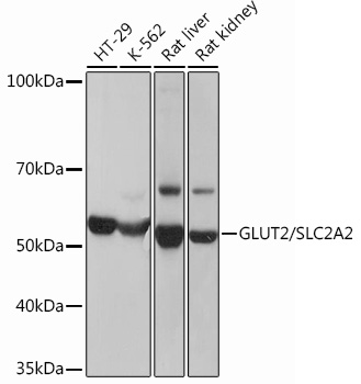 Western blot analysis of various lysates using GLUT2/SLC2A2 Rabbit mAb (TA425876) at 1：1000 dilution.<br/>Secondary antibody: HRP-conjugated Goat anti-Rabbit IgG (H+L) at 1:10000 dilution.<br/>Lysates/proteins: 25μg per lane.<br/>Blocking buffer: 3% nonfat dry milk in TBST.<br/>Detection: ECL Basic Kit .<br/>Exposure time: 3s.