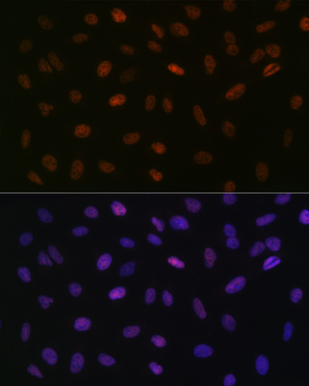 Confocal imaging of C2C12 cells using ASH2L Rabbit mAb (TA425889, dilution 1:100) followed by a further incubation with Cy3 Goat Anti-Rabbit IgG (H+L) (AS007, dilution 1:500) (Red). The cells were counterstained with α-Tubulin Mouse mAb (AC012, dilution 1:400) followed by incubation with ABflo® 488-conjugated Goat Anti-Mouse IgG (H+L) Ab (AS076, dilution 1:500) (Green).DAPI was used for nuclear staining (Blue). Objective: 100x.