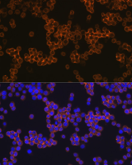 Confocal imaging of THP-1 cells  using CD14 Rabbit mAb (TA425906,dilution 1:100)  followed by a further incubation with Cy3 Goat Anti-Rabbit IgG (H+L) (AS007,dilution 1:500)(Red).DAPI was used for nuclear staining (Blue). Objective: 100x.