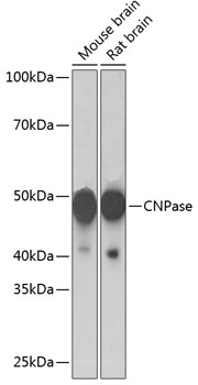 Western blot analysis of various lysates using CNPase Rabbit mAb (TA425929) at 1:1000 dilution.<br/>Secondary antibody: HRP-conjugated Goat anti-Rabbit IgG (H+L) at 1:10000 dilution.<br/>Lysates/proteins: 25μg per lane.<br/>Blocking buffer: 3% nonfat dry milk in TBST.<br/>Detection: ECL Basic Kit .<br/>Exposure time: 10s.