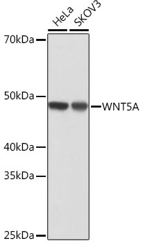 Western blot analysis of various lysates using WNT5A Rabbit mAb (TA425937) at 1:1000 dilution.<br/>Secondary antibody: HRP-conjugated Goat anti-Rabbit IgG (H+L) at 1:10000 dilution.<br/>Lysates/proteins: 25μg per lane.<br/>Blocking buffer: 3% nonfat dry milk in TBST.<br/>Detection: ECL Basic Kit .<br/>Exposure time: 10s.
