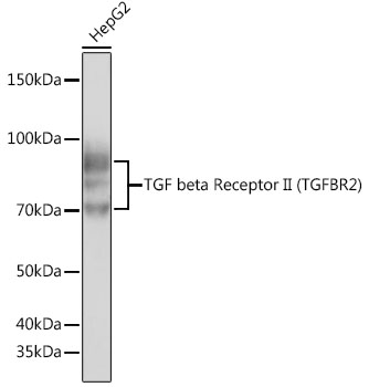 Western blot analysis of lysates from Hep G2 cells, using TGF beta Receptor II (TGFBR2) Rabbit mAb (TA425939) at 1:500 dilution.<br/>Secondary antibody: HRP-conjugated Goat anti-Rabbit IgG (H+L) at 1:10000 dilution.<br/>Lysates/proteins: 25μg per lane.<br/>Blocking buffer: 3% nonfat dry milk in TBST.<br/>Detection: ECL Basic Kit .<br/>Exposure time: 10s.