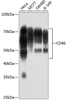 Western blot analysis of various lysates using CD46 Rabbit mAb (TA425943) at 1:1000 dilution.<br/>Secondary antibody: HRP-conjugated Goat anti-Rabbit IgG (H+L) at 1:10000 dilution.<br/>Lysates/proteins: 25μg per lane.<br/>Blocking buffer: 3% nonfat dry milk in TBST.<br/>Detection: ECL Basic Kit .<br/>Exposure time: 3min.