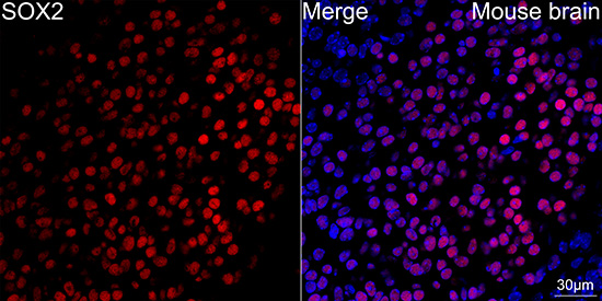 Confocal imaging of mouse brain(frozen section) using SOX2 Rabbit mAb (TA425955,at dilution of 1:100) (Red). DAPI was used for nuclear staining (blue). Objective: 40x.Perform microwave antigen retrieval with 10 mM citrate buffer pH 6.0 before commencing with IF staining protocol.