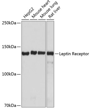 Western blot analysis of various lysates using Leptin Receptor Rabbit mAb (TA425957) at 1:1000 dilution.<br/>Secondary antibody: HRP-conjugated Goat anti-Rabbit IgG (H+L) at 1:10000 dilution.<br/>Lysates/proteins: 25μg per lane.<br/>Blocking buffer: 3% nonfat dry milk in TBST.<br/>Detection: ECL Basic Kit .<br/>Exposure time: 1min .