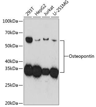 Western blot analysis of various lysates using Osteopontin Rabbit mAb (TA425967) at 1:1000 dilution incubated overnight at 4℃.<br/>Secondary antibody: HRP-conjugated Goat anti-Rabbit IgG (H+L) at 1:10000 dilution.<br/>Lysates/proteins: 25μg per lane.<br/>Blocking buffer: 3% nonfat dry milk in TBST.<br/>Detection: ECL Basic Kit .<br/>Exposure time: 3min.