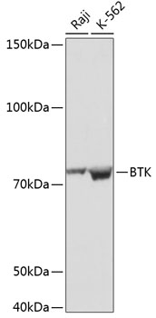 Western blot analysis of various lysates using BTK Rabbit mAb (TA425976) at 1:1000 dilution.<br/>Secondary antibody: HRP-conjugated Goat anti-Rabbit IgG (H+L) at 1:10000 dilution.<br/>Lysates/proteins: 25μg per lane.<br/>Blocking buffer: 3% nonfat dry milk in TBST.<br/>Detection: ECL Basic Kit .<br/>Exposure time: 3min.