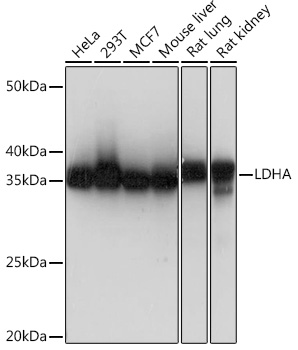 Western blot analysis of various lysates using LDHA Rabbit mAb (TA425984) at 1：1000 dilution.<br/>Secondary antibody: HRP-conjugated Goat anti-Rabbit IgG (H+L) at 1:10000 dilution.<br/>Lysates/proteins: 25μg per lane.<br/>Blocking buffer: 3% nonfat dry milk in TBST.<br/>Detection: ECL Basic Kit .<br/>Exposure time: 1s.