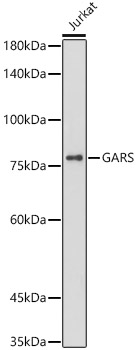 Western blot analysis of lysates from Jurkat cells, using KO Validated GARS Rabbit mAb (TA425988) at  1:1000 dilution.<br/>Secondary antibody: HRP-conjugated Goat anti-Rabbit IgG (H+L) at 1:10000 dilution.<br/>Lysates/proteins: 25μg per lane.<br/>Blocking buffer: 3% nonfat dry milk in TBST.<br/>Detection: ECL Basic Kit .<br/>Exposure time: 180s.