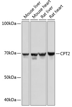 Western blot analysis of various lysates using CPT2 Rabbit mAb (TA425989) at 1：1000 dilution.<br/>Secondary antibody: HRP-conjugated Goat anti-Rabbit IgG (H+L) at 1:10000 dilution.<br/>Lysates/proteins: 25μg per lane.<br/>Blocking buffer: 3% nonfat dry milk in TBST.<br/>Detection: ECL Basic Kit .<br/>Exposure time: 5s.