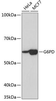 Western blot analysis of various lysates using G6PD Rabbit mAb (TA426009) at 1:1000 dilution.<br/>Secondary antibody: HRP-conjugated Goat anti-Rabbit IgG (H+L) at 1:10000 dilution.<br/>Lysates/proteins: 25μg  per lane.<br/>Blocking buffer: 3% nonfat dry milk in TBST.<br/>Detection: ECL Basic Kit .<br/>Exposure time: 5s.