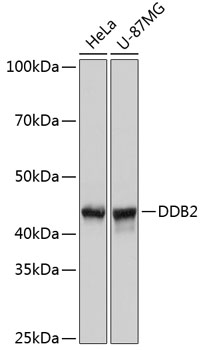 Western blot analysis of various lysates using DDB2 Rabbit mAb (TA426063) at 1:1000 dilution.<br/>Secondary antibody: HRP-conjugated Goat anti-Rabbit IgG (H+L) at 1:10000 dilution.<br/>Lysates/proteins: 25μg per lane.<br/>Blocking buffer: 3% nonfat dry milk in TBST.<br/>Detection: ECL Basic Kit .<br/>Exposure time: 3s.