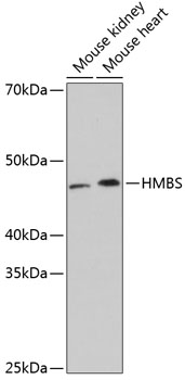 Western blot analysis of various lysates using HMBS Rabbit mAb (TA426086) at 1:1000 dilution.<br/>Secondary antibody: HRP-conjugated Goat anti-Rabbit IgG (H+L) at 1:10000 dilution.<br/>Lysates/proteins: 25μg per lane.<br/>Blocking buffer: 3% nonfat dry milk in TBST.<br/>Detection: ECL Basic Kit .<br/>Exposure time: 3min.