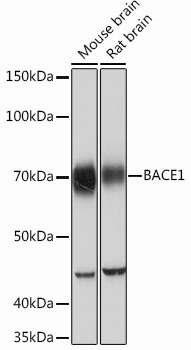 Western blot analysis of various lysates using BACE1 Rabbit mAb (TA426089) at 1：1000 dilution.<br/>Secondary antibody: HRP-conjugated Goat anti-Rabbit IgG (H+L) at 1:10000 dilution.<br/>Lysates/proteins: 25μg per lane.<br/>Blocking buffer: 3% nonfat dry milk in TBST.<br/>Detection: ECL Basic Kit .<br/>Exposure time: 10s.