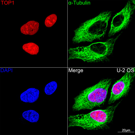 Confocal imaging of U-2 OS cells using DNA topoisomerase I (TOP1) Rabbit mAb (TA426097,dilution 1:100)(Red). The cells were counterstained with α-Tubulin Mouse mAb (AC012,dilution 1:400) (Green). DAPI was used for nuclear staining (blue). Objective: 100x.