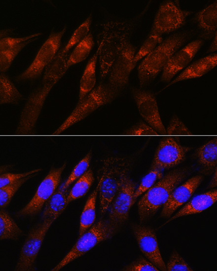 Confocal imaging of C2C12 cells using PDHA1 Rabbit mAb (TA426107, dilution 1:200) followed by a further incubation with Cy3 Goat Anti-Rabbit IgG (H+L) (AS007, dilution 1:500) (Red). The cells were counterstained with α-Tubulin Mouse mAb (AC012, dilution 1:400) followed by incubation with ABflo® 488-conjugated Goat Anti-Mouse IgG (H+L) Ab (AS076, dilution 1:500) (Green). DAPI was used for nuclear staining (Blue). Objective: 100x.