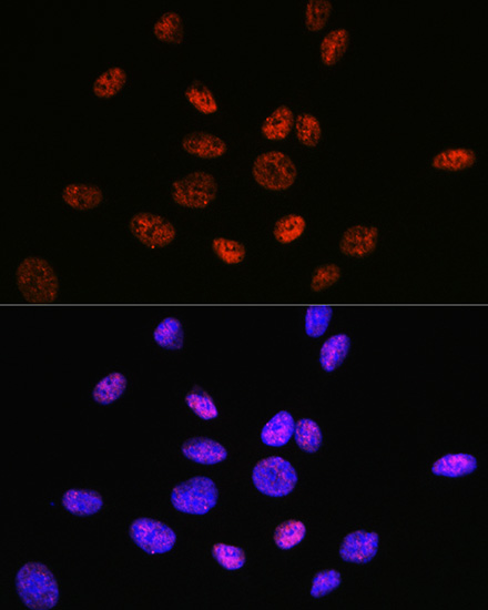 Confocal imaging of U-2 OS cells using HDAC9 Rabbit mAb (TA426112, dilution 1:100) followed by a further incubation with Cy3 Goat Anti-Rabbit IgG (H+L) (AS007, dilution 1:500) (Red). The cells were counterstained with α-Tubulin Mouse mAb (AC012, dilution 1:400) followed by incubation with ABflo® 488-conjugated Goat Anti-Mouse IgG (H+L) Ab (AS076, dilution 1:500) (Green). DAPI was used for nuclear staining (Blue). Objective: 100x.