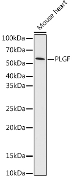 Western blot analysis of lysates from Mouse heart , using PLGF Rabbit mAb (TA426121) at 1:1000 dilution.<br/>Secondary antibody: HRP-conjugated Goat anti-Rabbit IgG (H+L) at 1:10000 dilution.<br/>Lysates/proteins: 25μg per lane.<br/>Blocking buffer: 3% nonfat dry milk in TBST.<br/>Detection: ECL Basic Kit .<br/>Exposure time: 180s.
