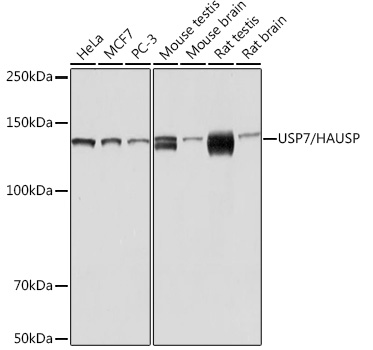 Western blot analysis of various lysates using USP7/HAUSP Rabbit mAb (TA426138) at 1：1000 dilution.<br/>Secondary antibody: HRP-conjugated Goat anti-Rabbit IgG (H+L) at 1:10000 dilution.<br/>Lysates/proteins: 25μg per lane.<br/>Blocking buffer: 3% nonfat dry milk in TBST.<br/>Detection: ECL Basic Kit .<br/>Exposure time: 10s.