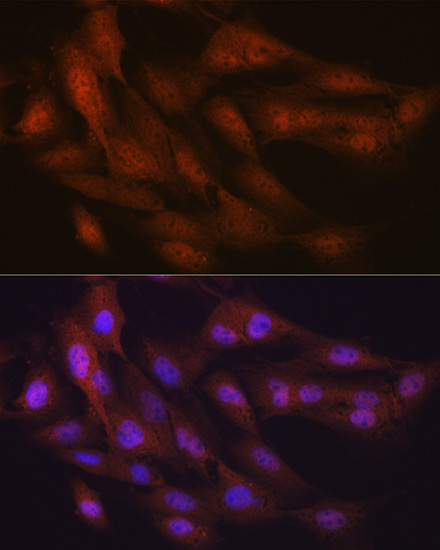 Confocal imaging of MCF7 cells  using K48-linkage Specific Ubiquitin Rabbit mAb (TA426157,dilution 1:100)  followed by a further incubation with Cy3 Goat Anti-Rabbit IgG (H+L) (AS007,dilution 1:500)(Red).The cells were counterstained with α-Tubulin Mouse mAb (AC012, dilution 1:400) followed by incubation with ABflo® 488-conjugated Goat Anti-Mouse IgG (H+L) Ab (AS076, dilution 1:500) (Green).DAPI was used for nuclear staining (Blue). Objective: 100x.