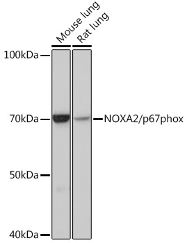 Western blot analysis of various lysates using NOXA2/p67phox Rabbit mAb (TA426167) at 1:1000 dilution.<br/>Secondary antibody: HRP-conjugated Goat anti-Rabbit IgG (H+L) at 1:10000 dilution.<br/>Lysates/proteins: 25μg per lane.<br/>Blocking buffer: 3% nonfat dry milk in TBST.<br/>Detection: ECL Basic Kit .<br/>Exposure time: 30s.