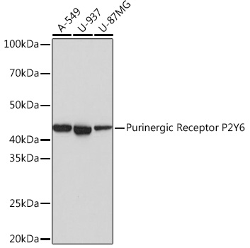 Western blot analysis of various lysates using Purinergic Receptor Purinergic Receptor P2Y6 Rabbit mAb (TA426170) at 1:1000 dilution.<br/>Secondary antibody: HRP-conjugated Goat anti-Rabbit IgG (H+L) at 1:10000 dilution.<br/>Lysates/proteins: 25μg per lane.<br/>Blocking buffer: 3% nonfat dry milk in TBST.<br/>Detection: ECL Basic Kit .<br/>Exposure time: 1s.