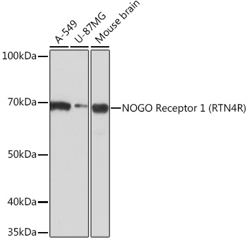 Western blot analysis of various lysates using NOGO Receptor 1 (RTN4R) Rabbit mAb (TA426197) at 1:1000 dilution.<br/>Secondary antibody: HRP-conjugated Goat anti-Rabbit IgG (H+L) at 1:10000 dilution.<br/>Lysates/proteins: 25μg per lane.<br/>Blocking buffer: 3% nonfat dry milk in TBST.<br/>Detection: ECL Basic Kit .<br/>Exposure time: 3min.