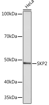 Western blot analysis of lysates from HeLa cells, using SKP2 Rabbit mAb (TA426205) at 1:1000 dilution.<br/>Secondary antibody: HRP-conjugated Goat anti-Rabbit IgG (H+L) at 1:10000 dilution.<br/>Lysates/proteins: 25μg per lane.<br/>Blocking buffer: 3% nonfat dry milk in TBST.<br/>Detection: ECL Basic Kit .<br/>Exposure time: 3min.