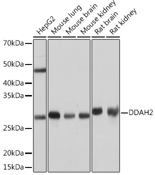 Western blot analysis of various lysates using DDAH2 Rabbit mAb (TA426221) at 1:1000 dilution.<br/>Secondary antibody: HRP-conjugated Goat anti-Rabbit IgG (H+L) at 1:10000 dilution.<br/>Lysates/proteins: 25μg per lane.<br/>Blocking buffer: 3% nonfat dry milk in TBST.<br/>Detection: ECL Basic Kit .<br/>Exposure time: 1s.