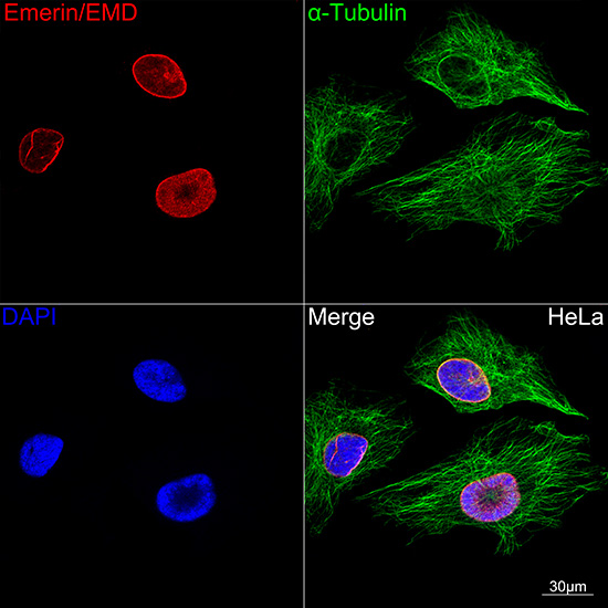 Confocal imaging of HeLa cells using Emerin/EMD Rabbit mAb (TA426230, dilution 1:100) (Red). The cells were counterstained with Alpha-tubulin (ubiquitous) chain Rabbit mAb (AC049, dilution 1:100) (Green). DAPI was used for nuclear staining (blue). Objective: 60x.