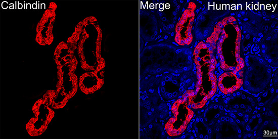 Confocal imaging of paraffin-embedded Rat brain tissue using Calbindin Rabbit mAb (TA426249, dilution 1:200) followed by a further incubation with Cy3 Goat Anti-Rabbit IgG (H+L) (AS007, dilution 1:500) (Red). DAPI was used for nuclear staining (Blue). Objective: 40x. Perform microwave antigen retrieval with 0.01 M citrate buffer (pH 6.0) prior to IF staining.
