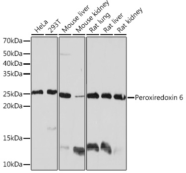 Western blot analysis of various lysates using Peroxiredoxin 6 Rabbit mAb (TA426250) at 1:1000 dilution.<br/>Secondary antibody: HRP-conjugated Goat anti-Rabbit IgG (H+L) at 1:10000 dilution.<br/>Lysates/proteins: 25μg per lane.<br/>Blocking buffer: 3% nonfat dry milk in TBST.<br/>Detection: ECL Basic Kit .<br/>Exposure time: 10s.