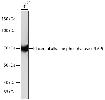 Western blot analysis of lysates from PC-3 cells, using Placental alkaline phosphatase (PLAP) Rabbit mAb (TA426255) at 1:1000 dilution.<br/>Secondary antibody: HRP-conjugated Goat anti-Rabbit IgG (H+L) at 1:10000 dilution.<br/>Lysates/proteins: 25μg per lane.<br/>Blocking buffer: 3% nonfat dry milk in TBST.<br/>Detection: ECL Basic Kit .<br/>Exposure time: 10s.