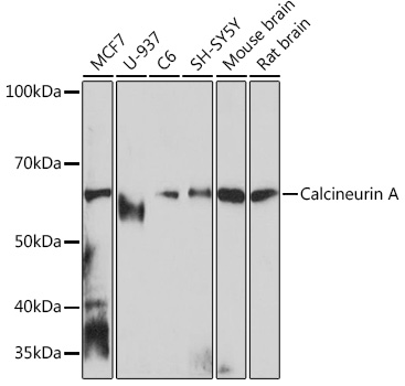 Western blot analysis of various lysates using Calcineurin A Rabbit mAb (TA426259) at 1:1000 dilution.<br/>Secondary antibody: HRP-conjugated Goat anti-Rabbit IgG (H+L) at 1:10000 dilution.<br/>Lysates/proteins: 25μg per lane.<br/>Blocking buffer: 3% nonfat dry milk in TBST.<br/>Detection: ECL Basic Kit .<br/>Exposure time: 10s.