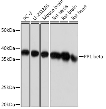 Western blot analysis of various lysates using PP1 beta Rabbit mAb (TA426268) at 1:1000 dilution.<br/>Secondary antibody: HRP-conjugated Goat anti-Rabbit IgG (H+L) at 1:10000 dilution.<br/>Lysates/proteins: 25μg per lane.<br/>Blocking buffer: 3% nonfat dry milk in TBST.<br/>Detection: ECL Basic Kit .<br/>Exposure time: 1s.