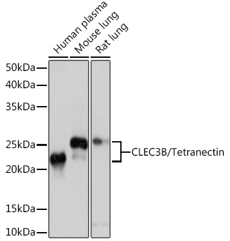 Western blot analysis of various lysates using CLEC3B/CLEC3B/Tetranectin Rabbit mAb (TA426277) at 1:1000 dilution.<br/>Secondary antibody: HRP-conjugated Goat anti-Rabbit IgG (H+L) at 1:10000 dilution.<br/>Lysates/proteins: 25μg per lane.<br/>Blocking buffer: 3% nonfat dry milk in TBST.<br/>Detection: ECL Basic Kit .<br/>Exposure time: 10s.