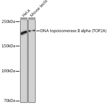 Western blot analysis of various lysates using DNA DNA topoisomerase II alpha (TOP2A) Rabbit mAb (TA426278) at 1:1000 dilution.<br/>Secondary antibody: HRP-conjugated Goat anti-Rabbit IgG (H+L) at 1:10000 dilution.<br/>Lysates/proteins: 25μg per lane.<br/>Blocking buffer: 3% nonfat dry milk in TBST.<br/>Detection: ECL Basic Kit .<br/>Exposure time: 3s.