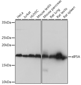 Western blot analysis of various lysates using eIF5A Rabbit mAb (TA426282) at 1:1000 dilution.<br/>Secondary antibody: HRP-conjugated Goat anti-Rabbit IgG (H+L) at 1:10000 dilution.<br/>Lysates/proteins: 25μg per lane.<br/>Blocking buffer: 3% nonfat dry milk in TBST.<br/>Detection: ECL Basic Kit .<br/>Exposure time: 1s.