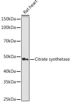Western blot analysis of lysates from rat heart , using Citrate synthetase Rabbit mAb (TA426306) at 1:1000 dilution.<br/>Secondary antibody: HRP-conjugated Goat anti-Rabbit IgG (H+L) at 1:10000 dilution.<br/>Lysates/proteins: 25μg per lane.<br/>Blocking buffer: 3% nonfat dry milk in TBST.<br/>Detection: ECL Basic Kit .<br/>Exposure time: 180s.