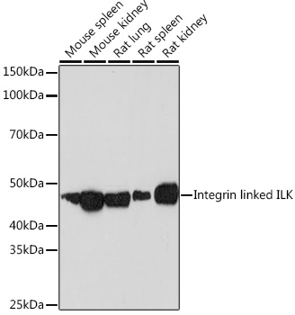 Western blot analysis of various lysates using Integrin linked ILK Rabbit mAb (TA426307) at 1:1000 dilution.<br/>Secondary antibody: HRP-conjugated Goat anti-Rabbit IgG (H+L) at 1:10000 dilution.<br/>Lysates/proteins: 25μg per lane.<br/>Blocking buffer: 3% nonfat dry milk in TBST.<br/>Detection: ECL Basic Kit .<br/>Exposure time: 10s.
