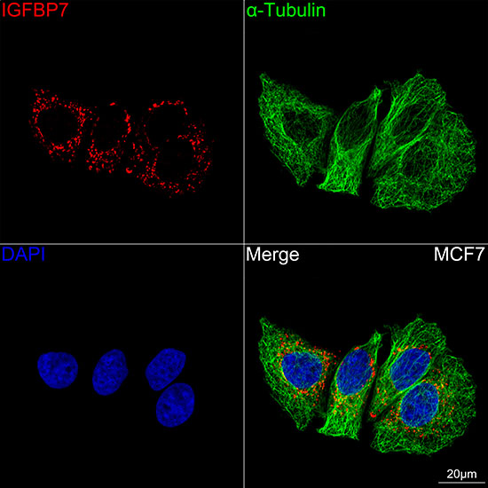 Confocal imaging of MCF7 cells using IGFBP7 Rabbit mAb (TA426317,at dilution of 1:100) (Red). The cells were counterstained with α-Tubulin Mouse mAb (AC012,dilution 1:400) (Green). DAPI was used for nuclear staining (blue). Objective: 100x.