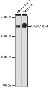 Western blot analysis of various lysates using ErbB4/HER4 Rabbit mAb (TA426332) at 1:1000 dilution.<br/>Secondary antibody: HRP-conjugated Goat anti-Rabbit IgG (H+L) at 1:10000 dilution.<br/>Lysates/proteins: 25μg per lane.<br/>Blocking buffer: 3% nonfat dry milk in TBST.<br/>Detection: ECL Basic Kit .<br/>Exposure time: 180s.