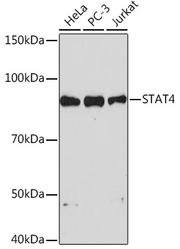 Western blot analysis of various lysates using STAT4 Rabbit mAb (TA426333) at 1:1000 dilution.<br/>Secondary antibody: HRP-conjugated Goat anti-Rabbit IgG (H+L) at 1:10000 dilution.<br/>Lysates/proteins: 25μg per lane.<br/>Blocking buffer: 3% nonfat dry milk in TBST.<br/>Detection: ECL Basic Kit .<br/>Exposure time: 90s.