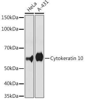 Confocal imaging of paraffin-embedded Human skin using Cytokeratin 10 Rabbit mAb (TA426339, dilution 1:200) followed by a further incubation with Cy3 Goat Anti-Rabbit IgG (H+L) (AS007, dilution 1:500) (Red). DAPI was used for nuclear staining (Blue). Objective: 40x.Perform high pressure antigen retrieval with 0.01M citrate buffer (pH 6.0) prior to IF staining.