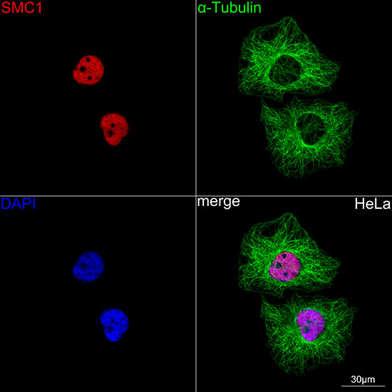 Confocal imaging of HeLa cells using SMC1 Rabbit mAb (TA426344,dilution 1:100)(Red). The cells were counterstained with α-Tubulin Mouse mAb (AC012,dilution 1:400) (Green). DAPI was used for nuclear staining (blue). Objective: 60x.