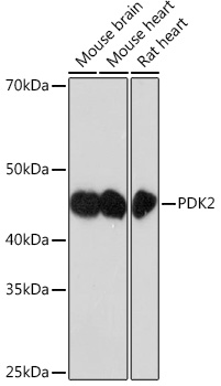 Western blot analysis of various lysates using PDK2 Rabbit mAb (TA426355) at 1:1000 dilution.<br/>Secondary antibody: HRP-conjugated Goat anti-Rabbit IgG (H+L) at 1:10000 dilution.<br/>Lysates/proteins: 25μg per lane.<br/>Blocking buffer: 3% nonfat dry milk in TBST.<br/>Detection: ECL Enhanced Kit .<br/>Exposure time: 3min.