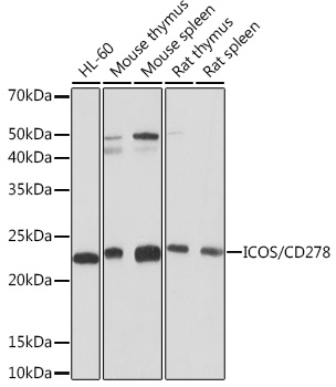 Western blot analysis of various lysates using ICOS/CD278 Rabbit mAb (TA426372) at 1:1000 dilution.<br/>Secondary antibody: HRP-conjugated Goat anti-Rabbit IgG (H+L) at 1:10000 dilution.<br/>Lysates/proteins: 25μg per lane.<br/>Blocking buffer: 3% nonfat dry milk in TBST.<br/>Detection: ECL Basic Kit .<br/>Exposure time: 30s.