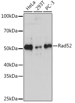 Western blot analysis of various lysates using Rad52 Rabbit mAb (TA426391) at 1:1000 dilution.<br/>Secondary antibody: HRP-conjugated Goat anti-Rabbit IgG (H+L) at 1:10000 dilution.<br/>Lysates/proteins: 25μg per lane.<br/>Blocking buffer: 3% nonfat dry milk in TBST.<br/>Detection: ECL Basic Kit .<br/>Exposure time: 3min.