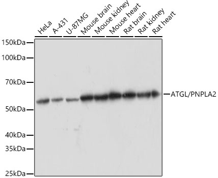 Western blot analysis of various lysates using ATGL/PNPLA2 Rabbit mAb (TA426397) at 1:1000 dilution.<br/>Secondary antibody: HRP-conjugated Goat anti-Rabbit IgG (H+L) at 1:10000 dilution.<br/>Lysates/proteins: 25μg per lane.<br/>Blocking buffer: 3% nonfat dry milk in TBST.<br/>Detection: ECL Basic Kit .<br/>Exposure time: 60s.